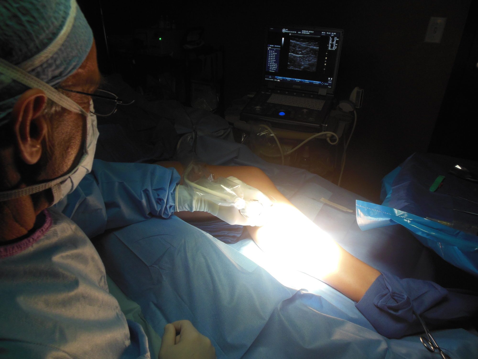 Endovenous Laser Treatment (EVLT) Tampa FL